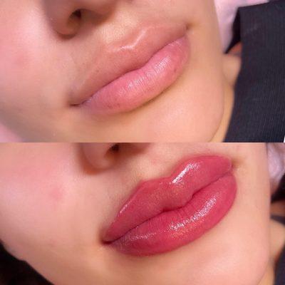 Rejuvenated Lips!