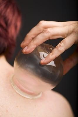 Each of our therapists has been trained cupping therapy.  We love it because it is so effective!