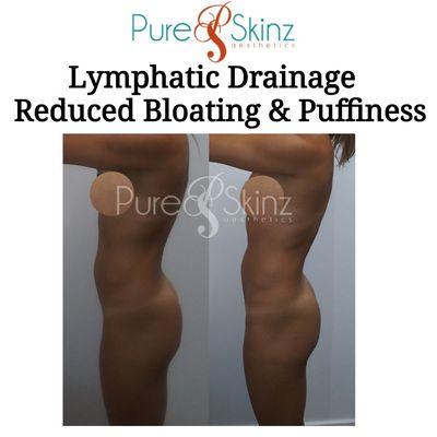 Results After Just 4 Sessions * Lymphatic Sculpting Lymphatic Drainage * Lymphatic Well-being