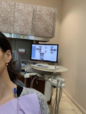 Dentist will go over x-rays and photos and put it on the monitor in front of you. Everything was very efficient and convenient