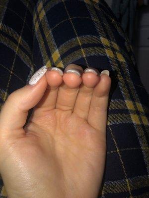 Thick nails