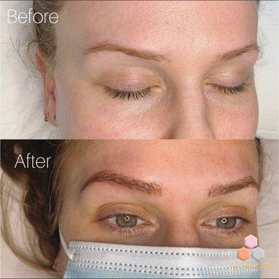 Microblading