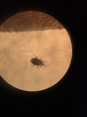 A Tropical Rat Mite under my microscope for a proper Identification.