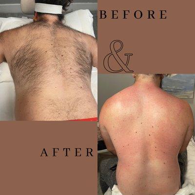 Full body Male waxing