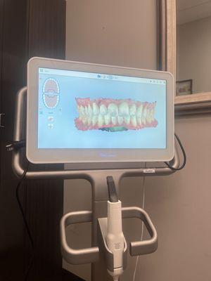 3D screening of teeth