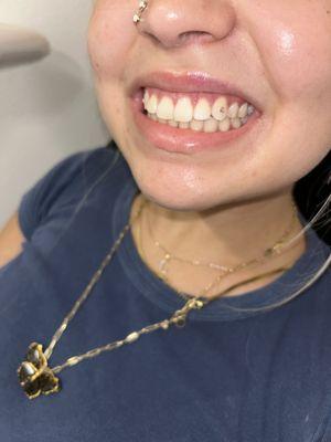 Az Teeth Whitening Spa offers gems! Get the experience of a sparkly smile!