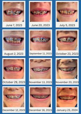 Progress check: 7 months of treatment!