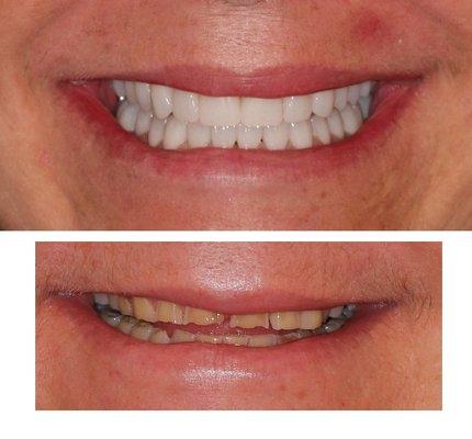 Smile enhancement at Dentistry Revolution!