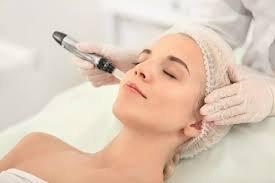 PRP / MICRONEEDLING great for acne scars, deeper lines and wrinkles, pigmentation