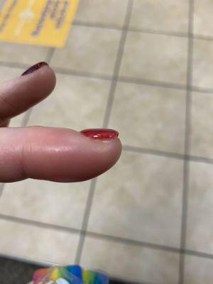 My finger that is infected after getting a manicure at this salon.