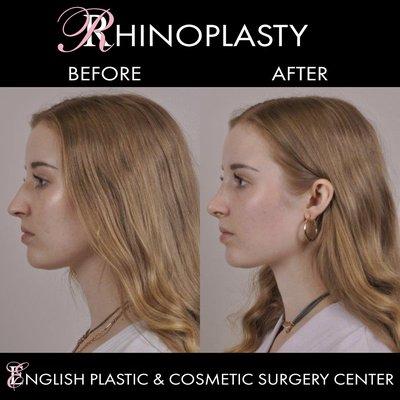 English Plastic and Cosmetic Surgery Center