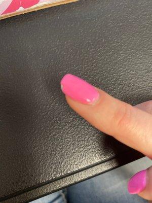 Chipped nail