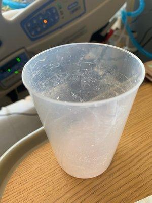 Nasty cup used with the patient and not just one time use.