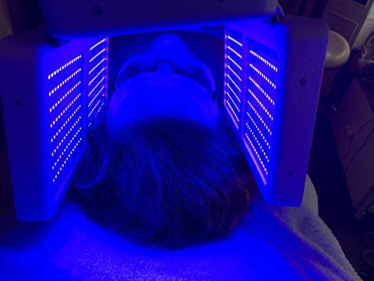 Blue LED kills p. Acne bacteria and is calming on the skin.