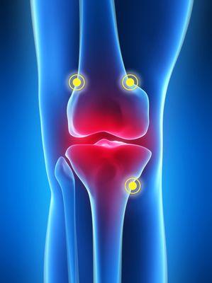 Nerve block and ablation for knee joint pain after surgery and during physical therapy and recovery