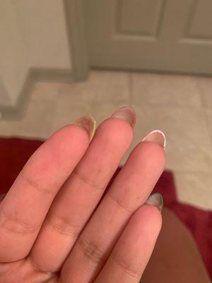 Tech did a sloppy job with the acrylic application and didn't not even bother to file off the mess they left under my nails