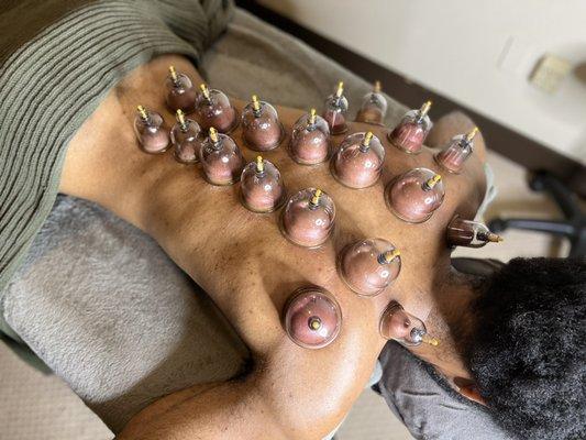 Add cupping therapy to your next massage.