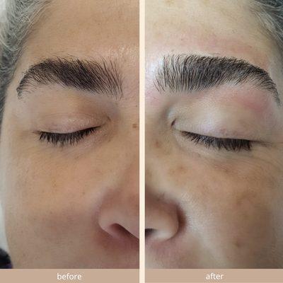 Brow Before + After