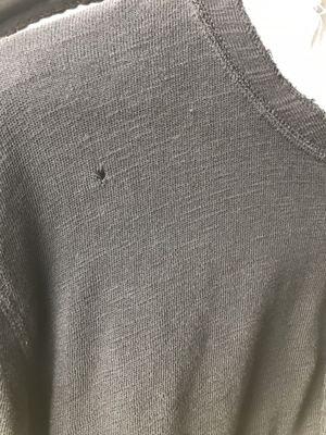 Hole left in my sweater after dry cleaning.