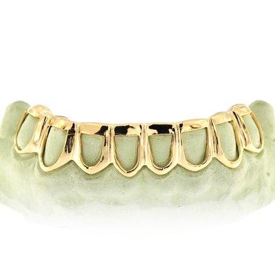 Custom Gold Teeth Grillz