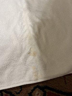 Stained retched smelling towel