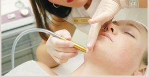 Microdermabrasion Alpharetta