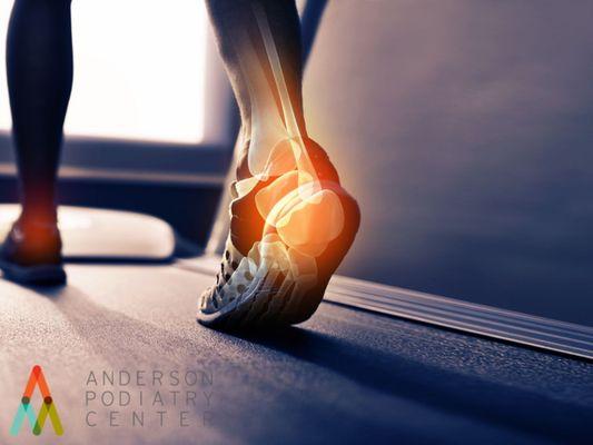 Heel pain after running