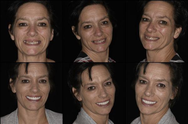 A life changing smile makeover