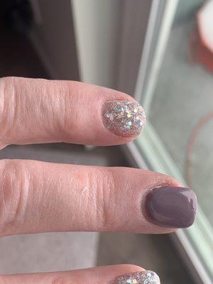 Crooked and doesn't match shape of other nails