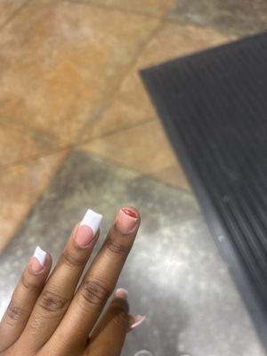 Nail broke