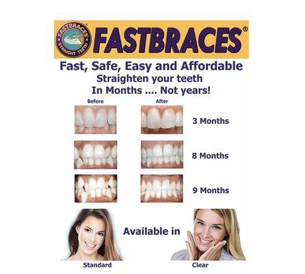 Don't spend years in braces- correct your smile under a year!