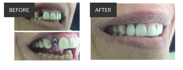 Restorative Dentistry