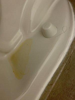 Hair and urine around the toilet.