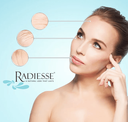 Radiess treatment - for deep lines and wrinkles.