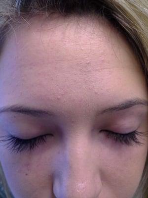 Eyelash Extensions