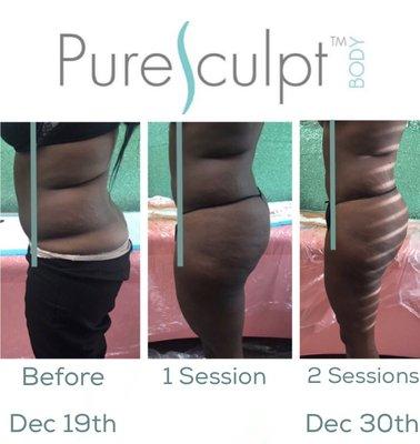 in 11 days she transformed her body with pure sculpt ORGANICALLY