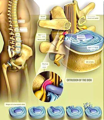 SpineAid Disc Center