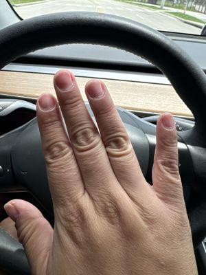 Worst manicure and removal of acrylics