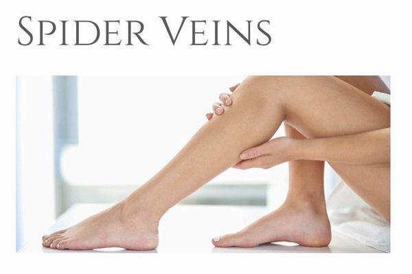 Specialize in the treatment of Varicose & Spider Veins