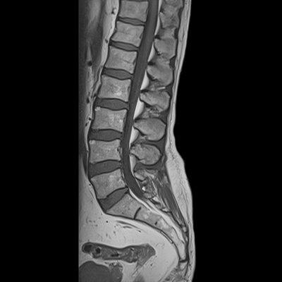 Example of L-Spine images