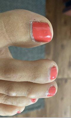 One week after pedicure. Notice the scratch from flip flop on thumb.