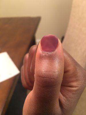 Finger that was cut during my manicure