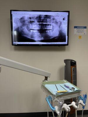 X-rays on computer monitor. Gotta start WaterPiking daily (yikes)