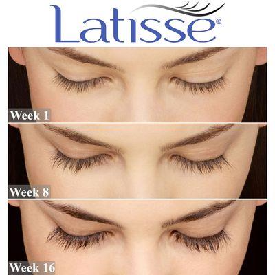 In Latisse clinical trials, at the end of 16 weeks, users' eyelashes were an average of 25% longer, 106% fuller, and 18% darker.