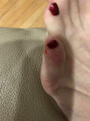 My left pinky toe. The skin surrounding the entire toe is inflamed. The cut is deep but it was hard to get a good angle.