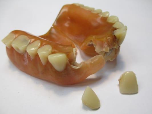 BEFORE - This badly broken denture is worn, and needs to be replaced. However, we can repair almost anything! (SEE "AFTER").