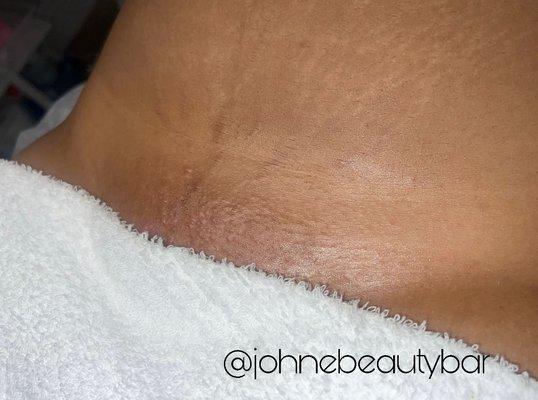 Brazilian Wax