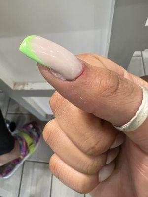 Made me bleed. Also why did she leave the gel hanging like that