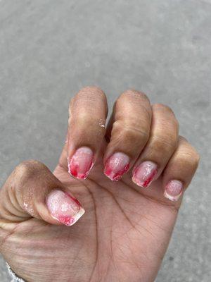 Nails after acetone was applied for 20 minutes