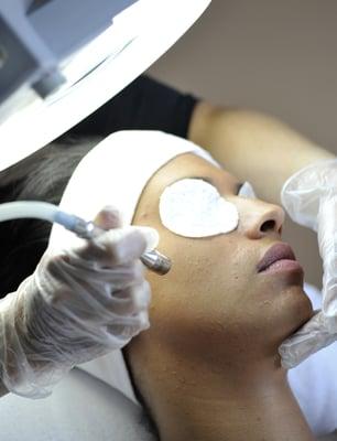 Microdermabrasion treatment by Feride